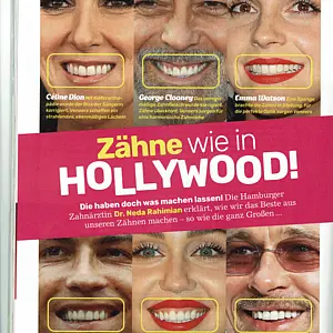News Image PRESSE - ZÄHNE WIE IN HOLLYWOOD